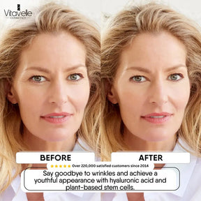 Stem Cell Anti - Aging Cream - Vitavelle Cosmetics USA